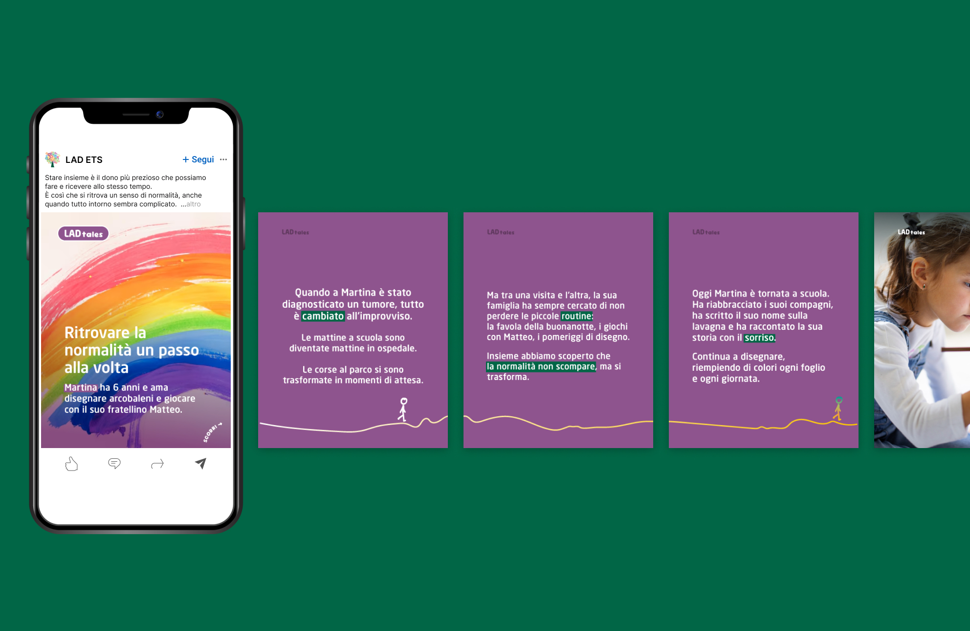 Mockup carosello LAD ETS: 3 slide viola narrative e una foto finale per raccontare la normalità oltre la malattia